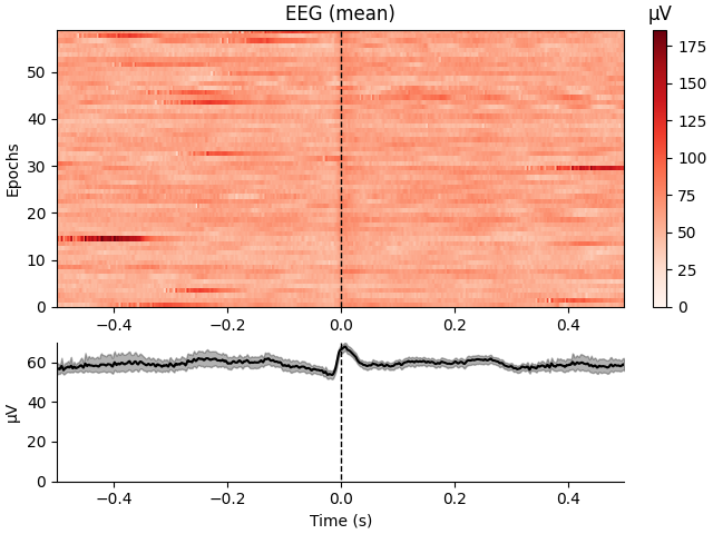 EEG (mean), µV