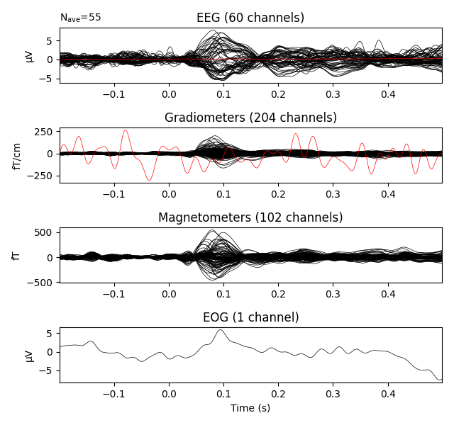 EEG (60 channels), Gradiometers (204 channels), Magnetometers (102 channels), EOG (1 channel)