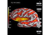 Compute spatial resolution metrics to compare MEG with EEG+MEG